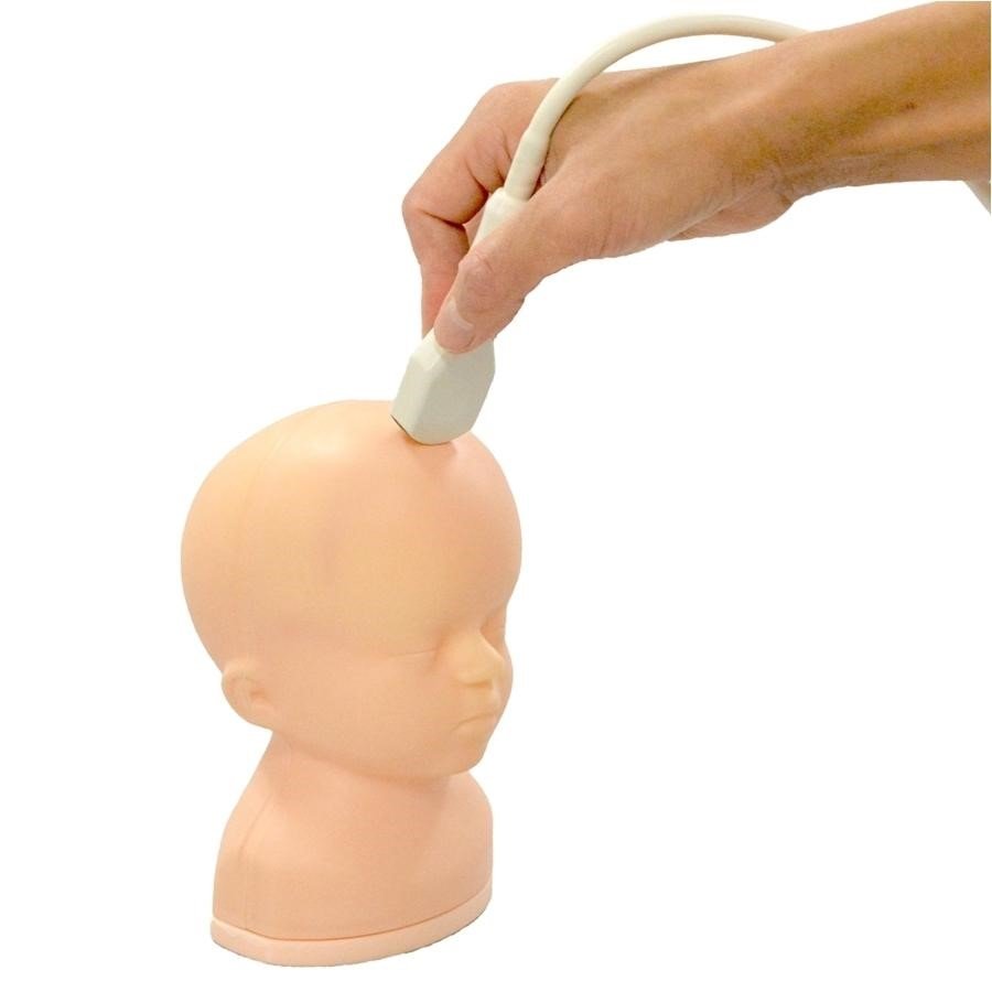 Não úng thủy 1