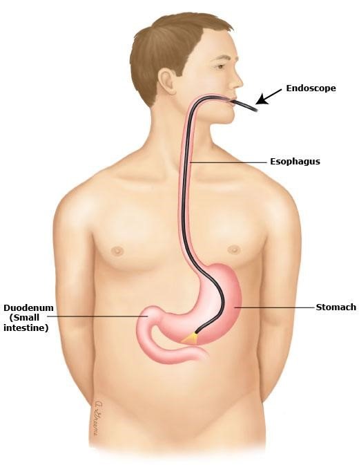 Phẫu thuật xâm lấn 5