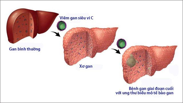 tình dục 5