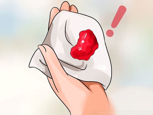 Ung thư đại tràng 2