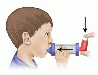 Bình xịt định liều 1