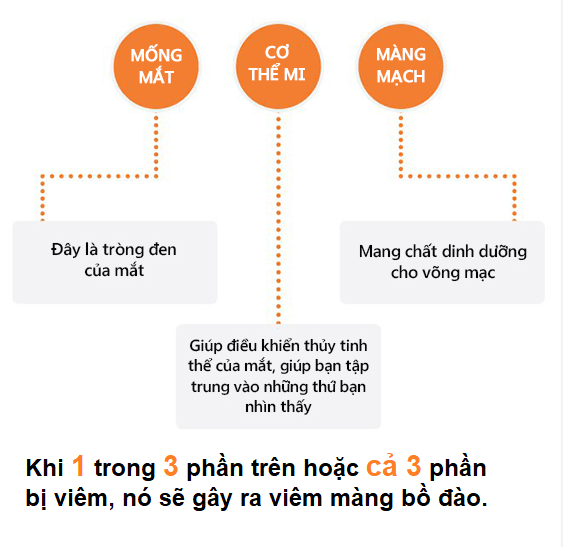 viêm màng bồ đào 2