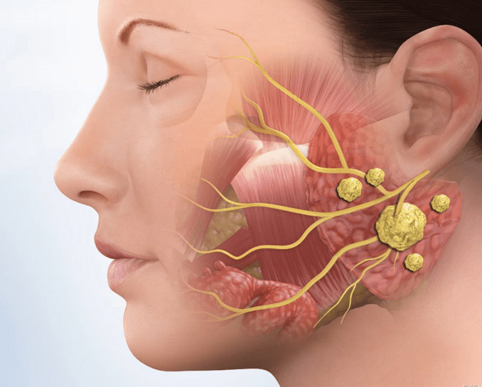 tuyến nước bọt 3