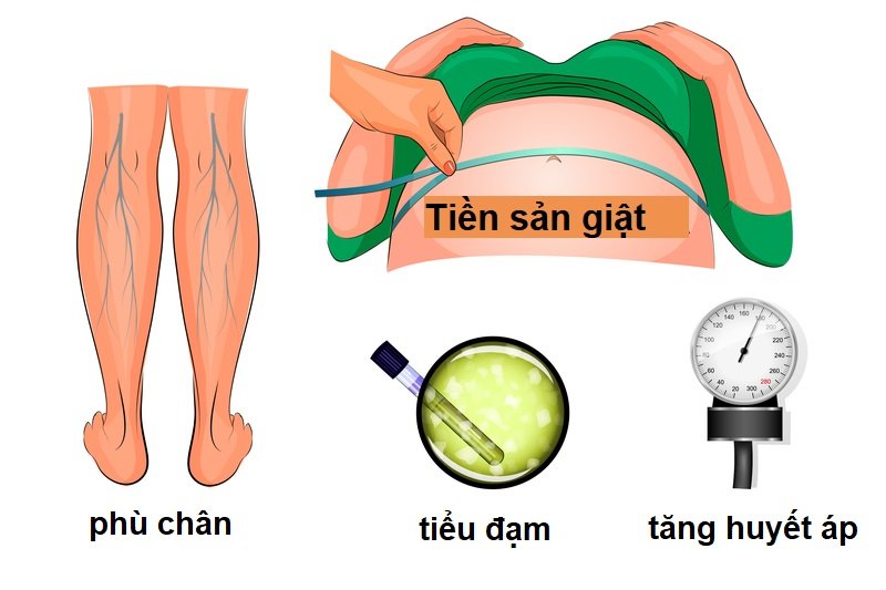 tiền sản giật 2