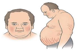 Corticoid 5