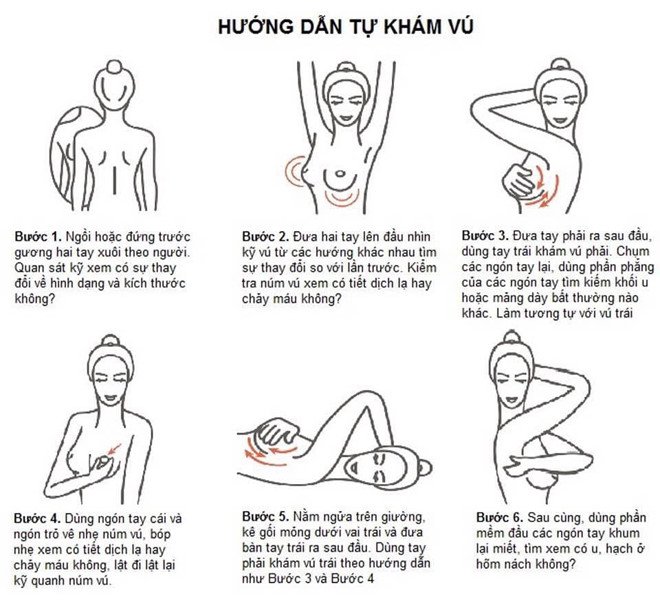 ung thư vú 2